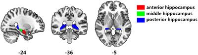 Abnormal resting-state functional connectivity of hippocampal subregions in type 2 diabetes mellitus-associated cognitive decline